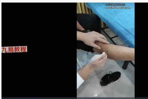【天医神针】系列网课视频79集 百度云下载！