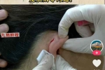 高血压克星（PDF+视频+图片）原众筹价3980（中成药和泡脚方）百度云下载！