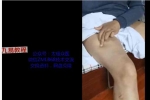 包医鼻炎点穴绝技+包医鼻炎药油配方 百度云下载！